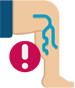 Varcoise veins treatment in Thane